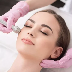 Microdermabrasion Full Facial